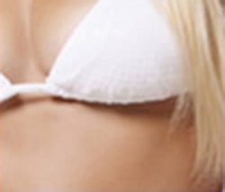 Plastische Chirurgie Essen Brust